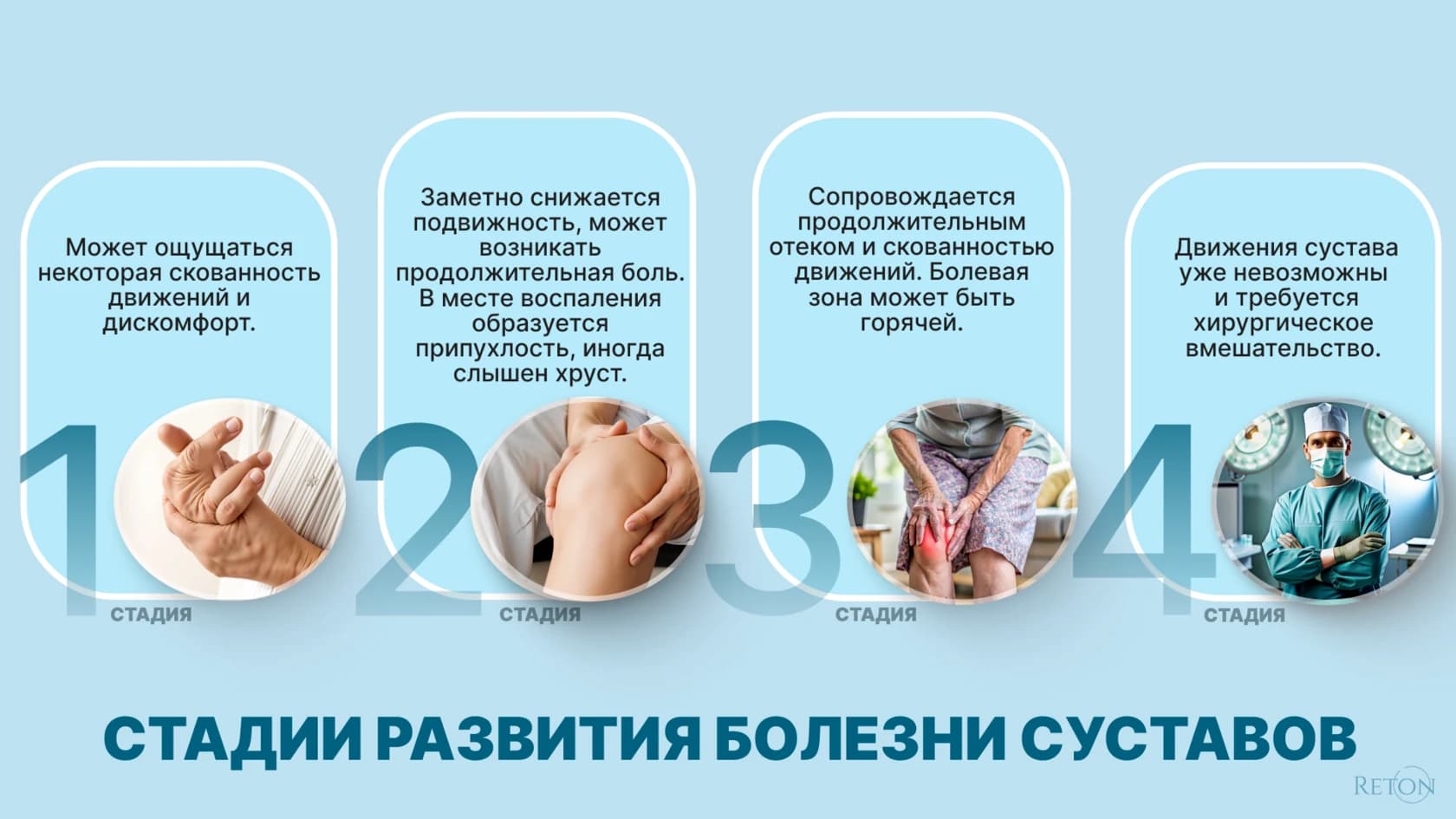 Возрастные изменения суставов